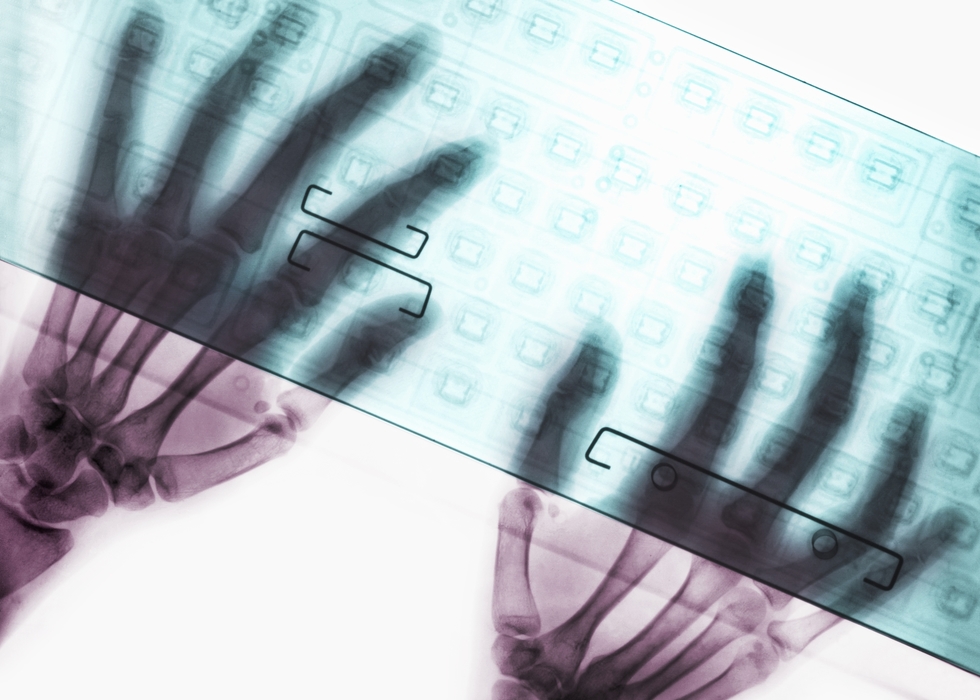 X-Ray Hands At Keyboard