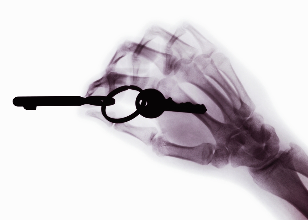 X-Ray Hand and Key