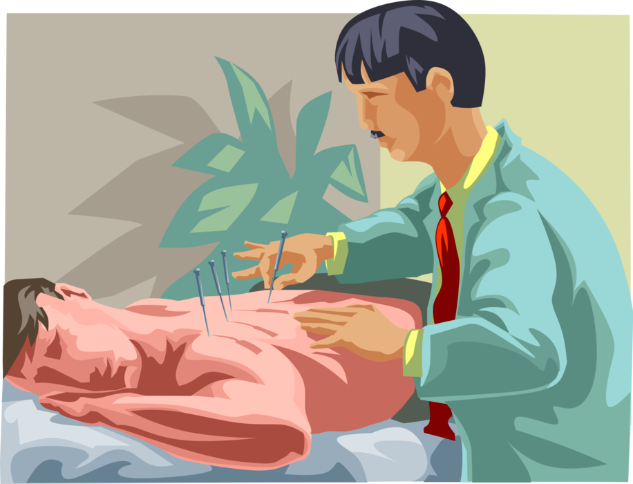 Vector Illustration of Alternative Medicine Pseudoscience Traditional Chinese Acupuncture Treatment