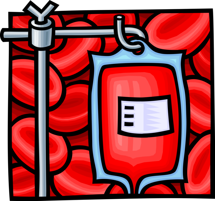 Vector Illustration of Medical Intravenous Therapy Blood Plasma Transfusion, IV Drip