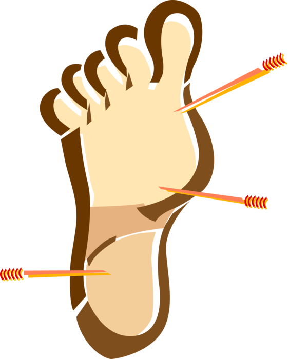 Vector Illustration of Alternative Medicine Traditional Chinese Acupuncture Treatment Pressure Points on Foot