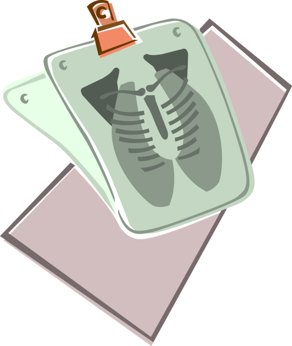 Vector Illustration of Hospital Chest X-Ray 