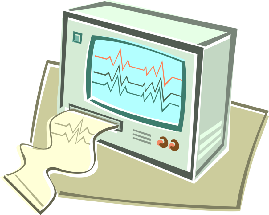 Vector Illustration of Electrocardiography Electrocardiogram Machine Printout