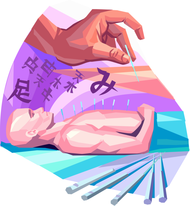 Vector Illustration of Pseudoscience Traditional Chinese Medicine Acupuncture Needles with Patient Receiving Treatment