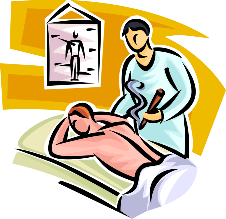 Vector Illustration of Alternative Medicine Traditional Chinese Acupuncture Treatment Fire Needle Technique